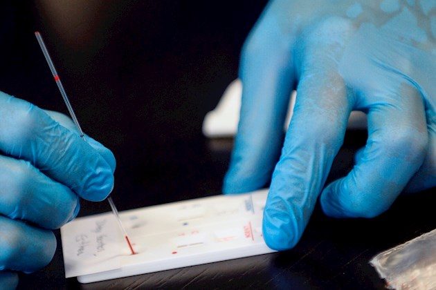 Este estudio, publicado en la revista JAMA, demuestra por tanto que la expresión de ACE2 en el epitelio nasal es más baja en los niños pequeños y que se incrementa en las personas adultas.