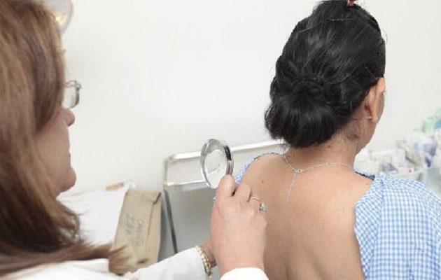 La exposición prolongada al sol es un factor de riesgo del cáncer de piel. Foto: Grupo Epasa