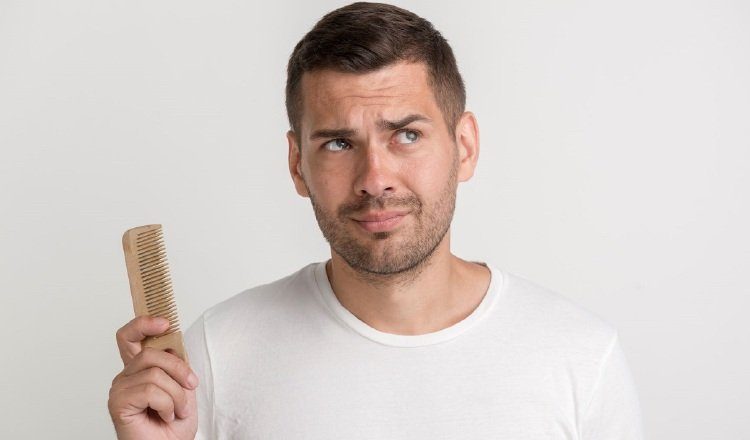 No todos los casos de alopecia o pérdida del cabello son iguales. Cortesía