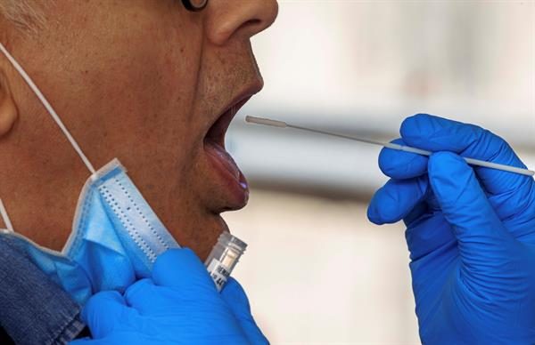 El 79 % de las personas analizadas produjeron anticuerpos en las dos primeras semanas desde el inicio de los síntomas.