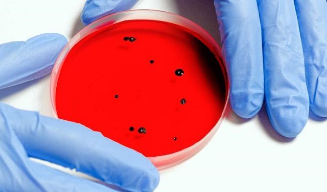 Se estudia cómo prevenir la resistencia a los antimicrobianos. Foto: Ilustrativa / Pexels
