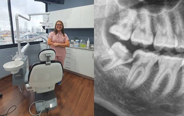 La doctora Yesneira Rodríguez aconseja realizar la extracción antes de los 25 años. Foto: Cortesía Y. Rodríguez