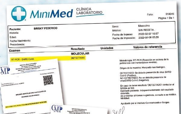 Pruebas realizadas con los resultados contradictorios.