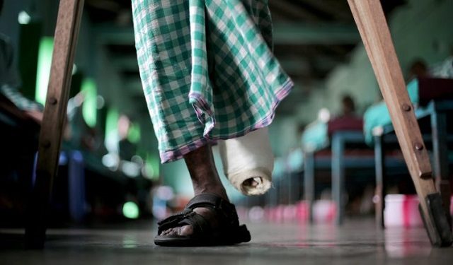 La lepra es una enfermedad muy relacionada con la pobreza.  Foto: EFE / EPA / Piyal Adhikary 