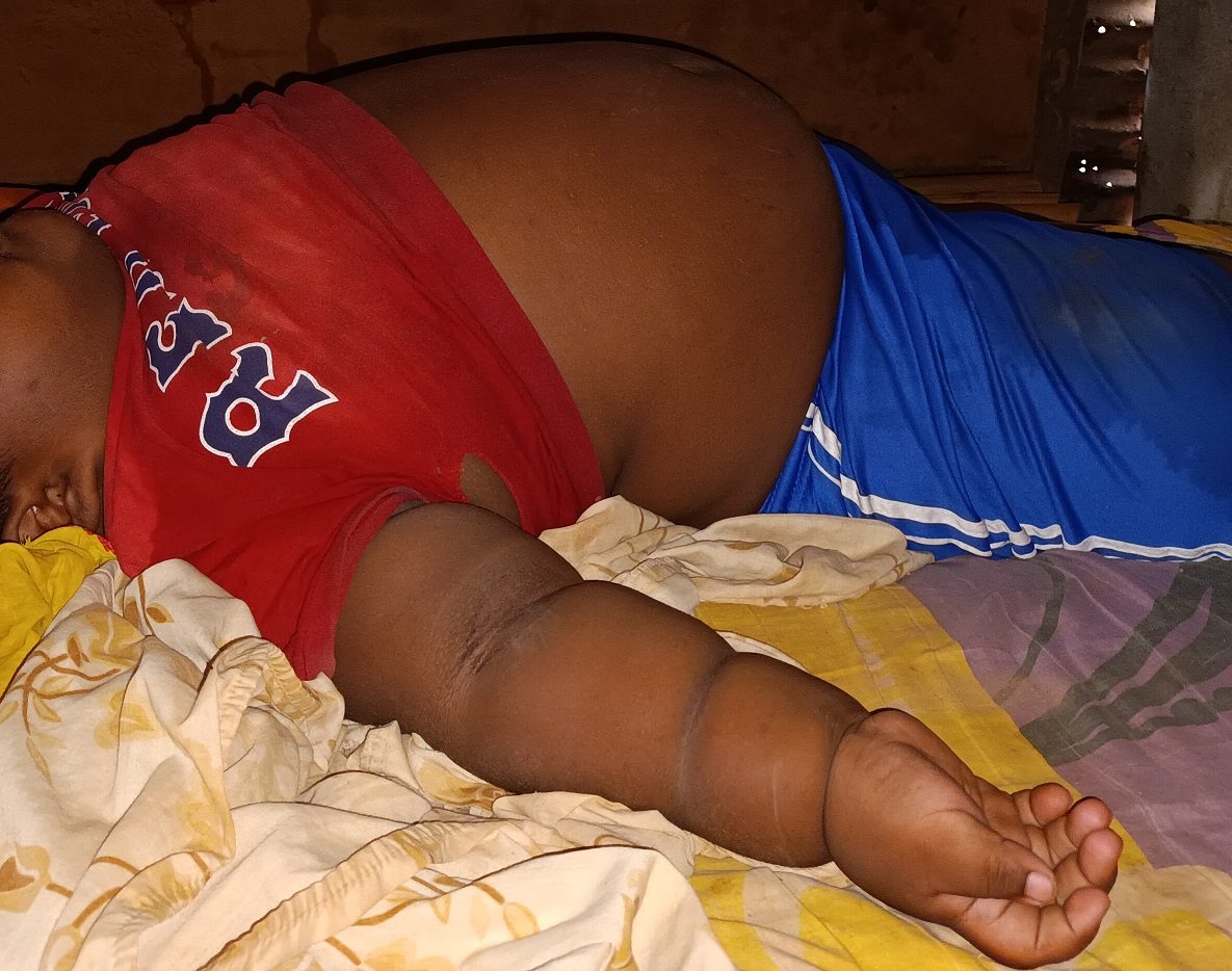 El menor mayormente afectado pesa unas 200 libras. Foto: Melquiades Vásquez 