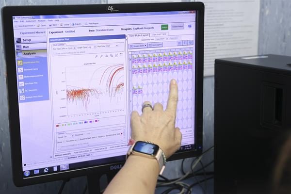 Trabajadores de un laboratorio analiza un muestra de la viruela del mono.