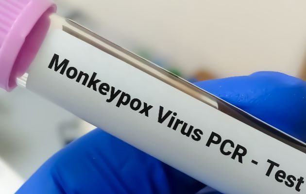 Desde el pasado 24 de mayo, Panamá declaró alerta sanitaria en todo el país y se redobló la vigilancia epidemiológica en todas las regiones de salud . Foto: Grupo Epasa