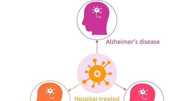 Las infecciones juegan un papel importante en el desarrollo de algunas enfermedades neurodegenerativas. Foto: EFE