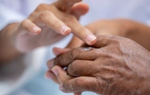 La lepra es una enfermedad infecciosa crónica que es curable y no contagiosa. Foto: Cortesía