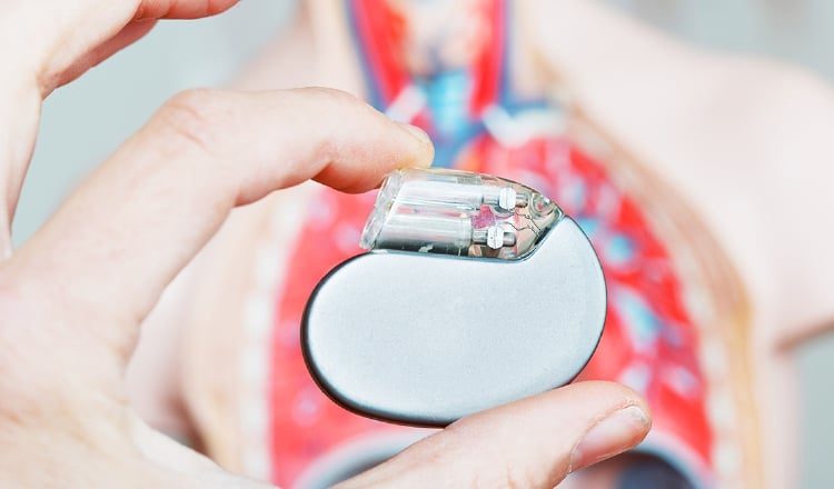 Los marcapasos  se usan para pacientes con  insuficiencia cardíaca.