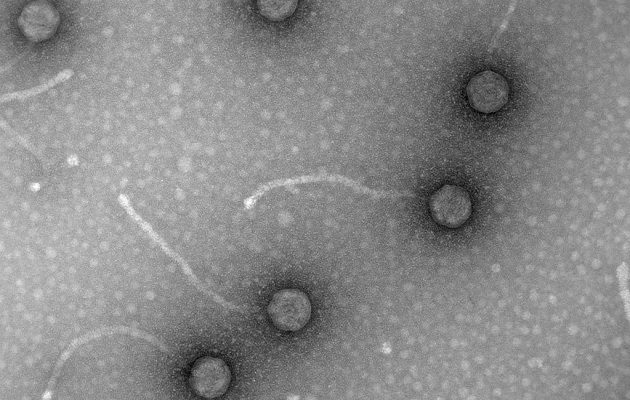 Micrografías de fagos, virus de bacterias, obtenidas en el laboratorio de Virología Ambiental y Biomédica del Instituto de Biología Integrativa de Sistemas (UV-CSIC).  Foto: EFE