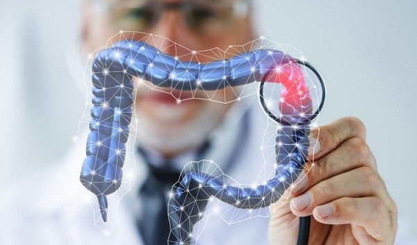 El cáncer de colon puede aparece a cualquier edad. Foto: Ilustrativa / Freepik
