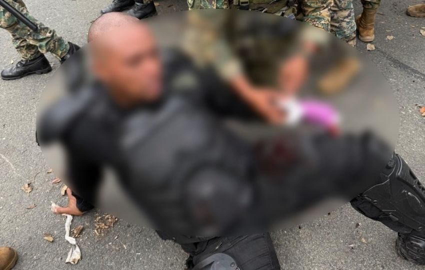 Oficial resultó herido en el sector de Arimae. Foto: Cortesía