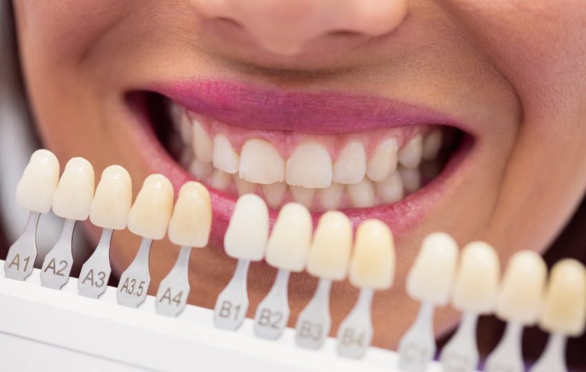 Las carillas dentales 'Natural 3D' ofrecen un aspecto más natural y estético. Foto: Ilustrativa / Freepik