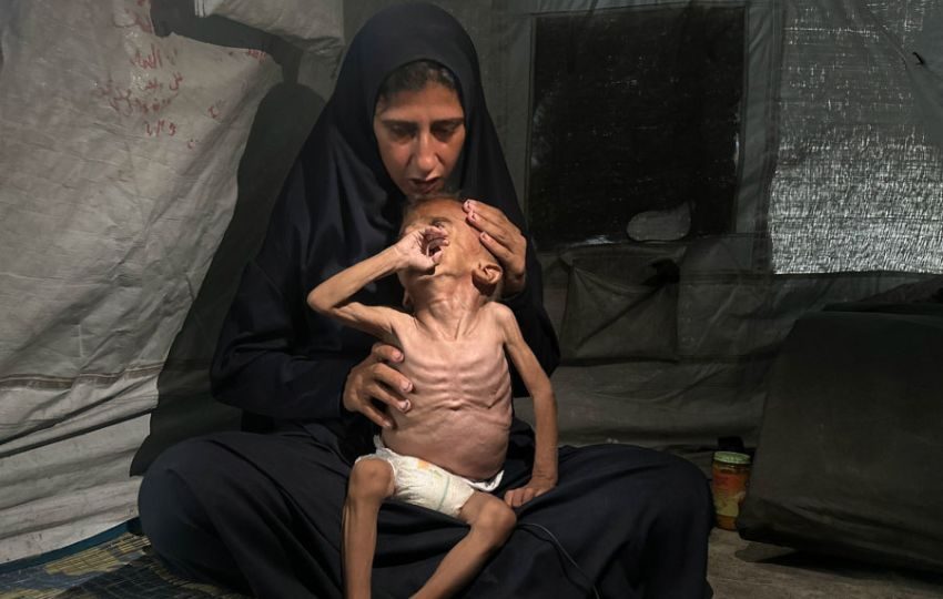 La crisis por desnutrición en Gaza ganó visibilidad con imágenes como las del pequeño Mohamed Motawaq. Foto: EFE