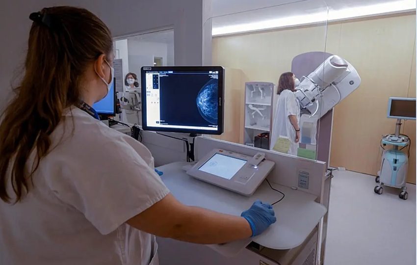 A partir de los 40 años debe hacerse la mamografía. Foto: EFE