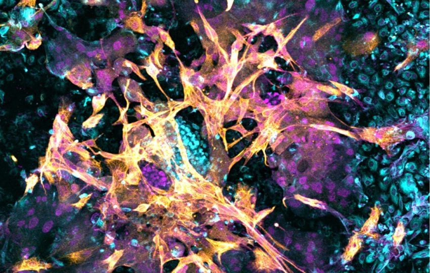 Imagen microscópica de un embrión humano de 14 días que se ha implantado en el nuevo modelo endometrial. Foto: Matteo Molè/EFE