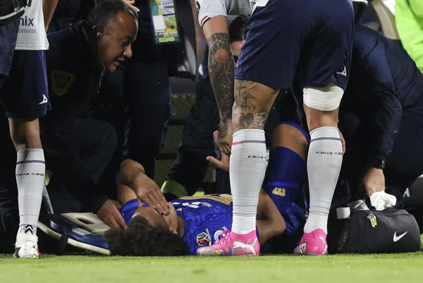 Adalberto 'Coco' Carrasquilla de Pumas se lesionó en la final de la Liga MX  ante Cruz Azul, en el estadio Olímpico Universitario en la Ciudad de México. Foto: EFE