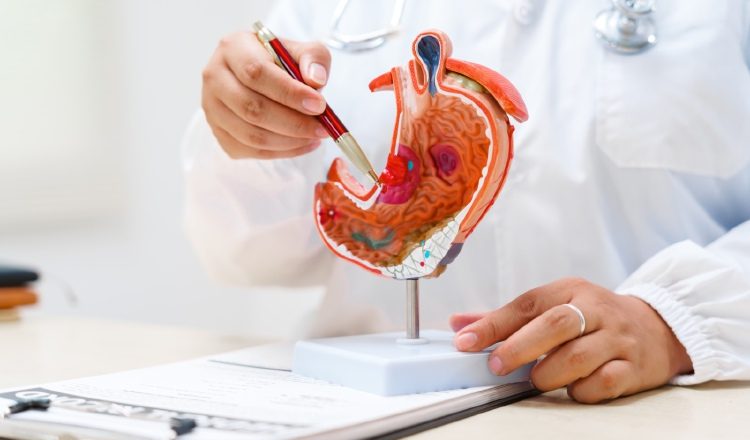 Panamá registra más de 620 de este tipo de cáncer al año. Foto: Cortesía