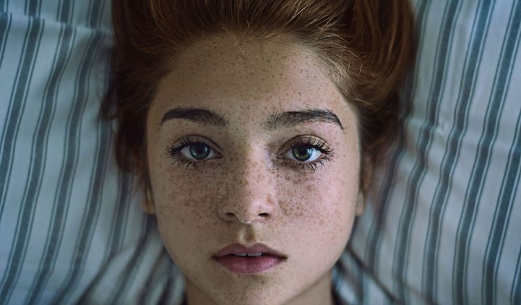 Las pecas cada vez gustan más, aunque quienes las poseen de forman natural luchan, como pueden, para camuflarlas a diario.  foto: web