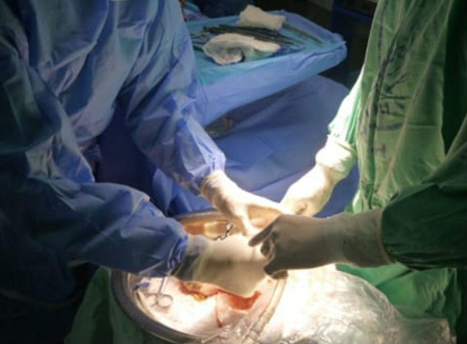 Actualmente el Tribunal Electoral a través de la cédula brinda a la persona la oportunidad de escoger si desea ser un donante de órgano o no. Foto/Mayra Madrid