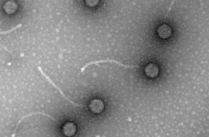 Micrografías de fagos, virus de bacterias, obtenidas en el laboratorio de Virología Ambiental y Biomédica del Instituto de Biología Integrativa de Sistemas (UV-
