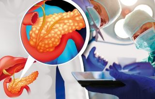 El cáncer de páncreas es muy agresivo. Foto: Ilustrativa / Freepik