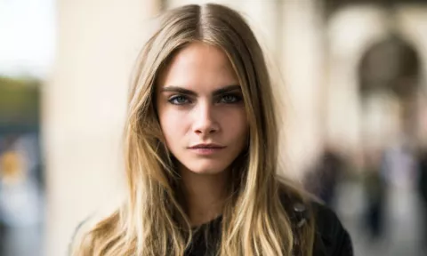Cara Delevingne sufre de psoriasis