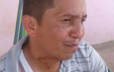 Ladrones le cortan el cuello con una botella quebrada a taxista santeño