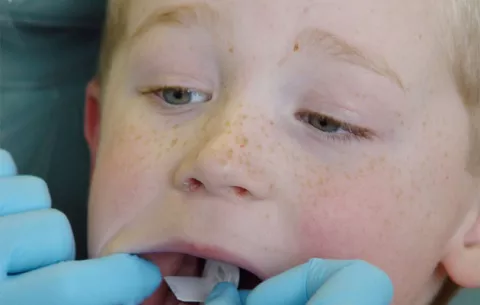 Recomiendan llevar a los niños al dentista en vacaciones