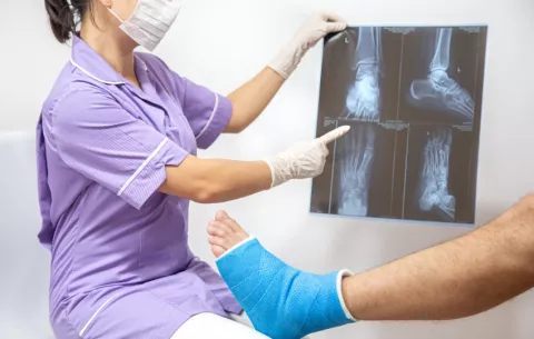 La mayoría de los tumores óseos no son cancerosos