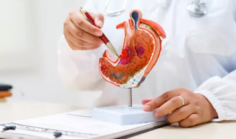 ¿Cómo la dieta podría acelerar el desarrollo del cáncer gástrico?