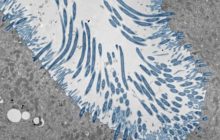 Micrografía electrónica de organoides epiteliales nasales humanos. Foto: EFE