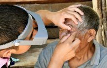 El tracoma es la principal causa de ceguera infecciosa a nivel mundial. Cortesía/Minsa