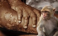El Minsa recomendó a la población acudir a un centro de salud si presenta alguno de los síntomas. Foto: Ilustrativa