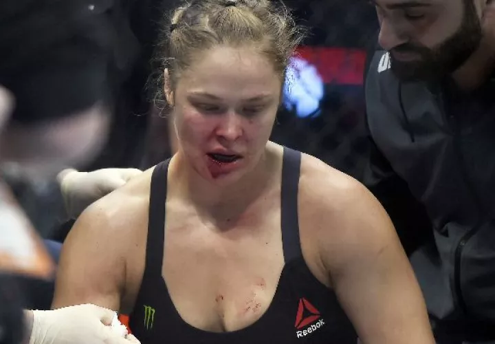 Rousey requirió sutura en los labios. 