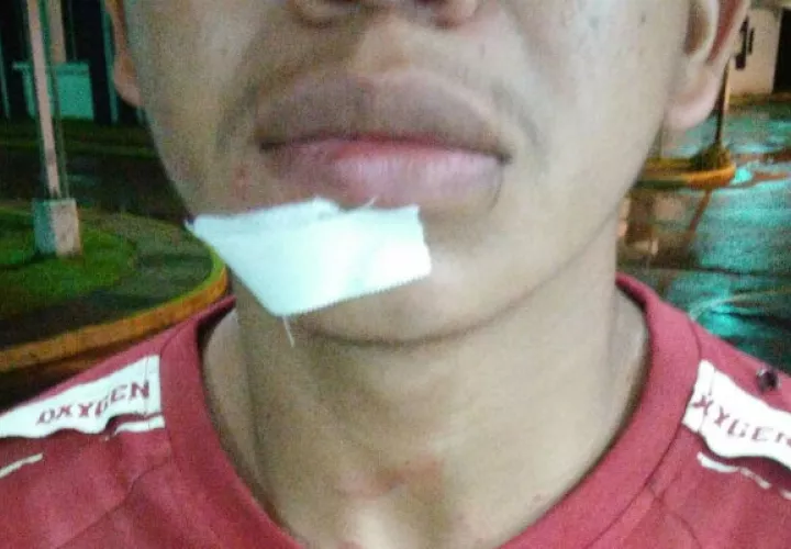 Herido con arma blanca. 