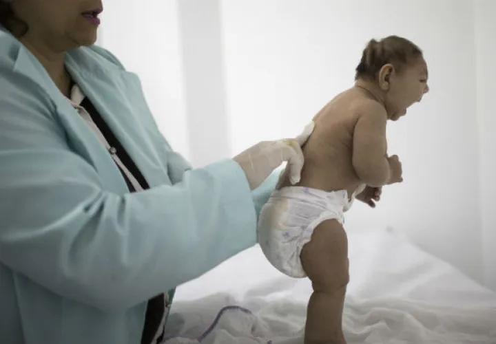  El reporte de los CDC, publicado en el New England Journal of Medicine, concluye que existe un vínculo, aunque no en todos los casos de mujeres embarazadas infectadas con zika. Foto/AP