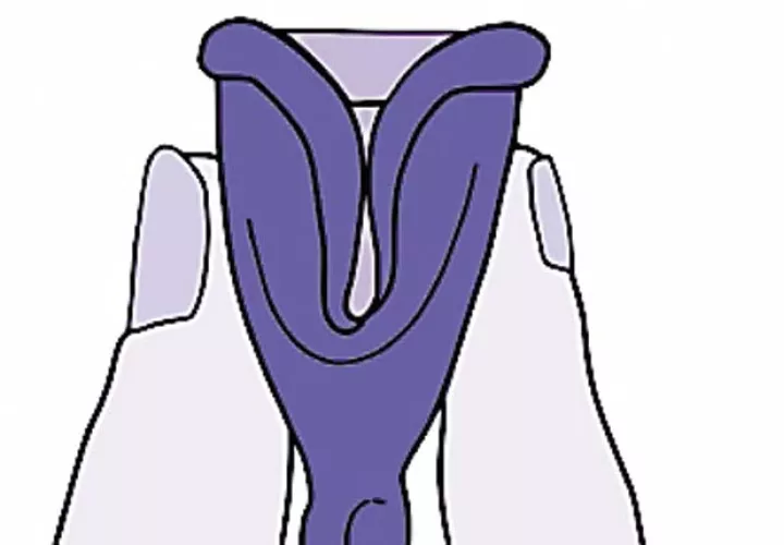 ¿Qué es la copa menstrual?