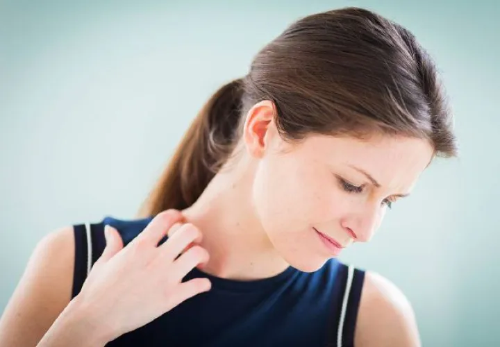 La psoriasis es una enfermedad difícil y frustrante que afecta la piel. /Foto Archivo