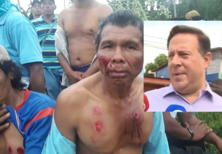 Desde Pesé, el mandatario dijo que no hay nadie con  'afectación seria' por los enfrentamientos. /Foto Archivo