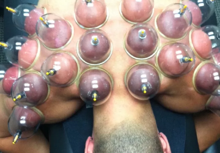 Esta terapia es de bajo riesgo y bajo costo, no invasiva. Según expertos, ayuda al alivio de dolores musculares y aumenta la circulación linfática.