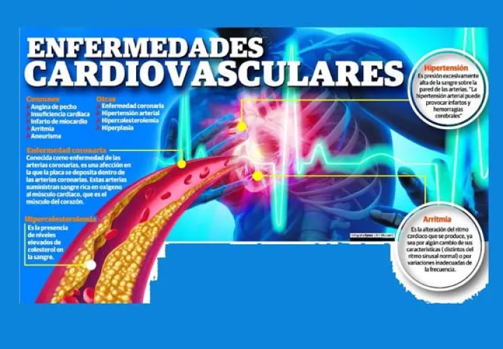 Enfermedades cardiovasculares