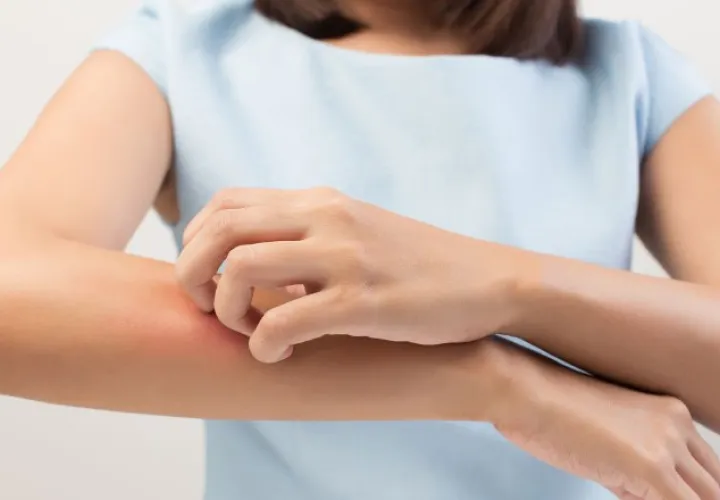 Informa al médico acerca de tus reacciones al látex y si has tenido otros signos y síntomas de alergia.  