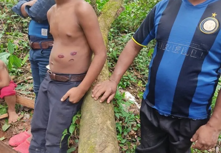l enfrentamiento se dio cuando la policía intentó desalojar a las  personas que permanecían en terrenos privados. Foto: Defensoría del Pueblo