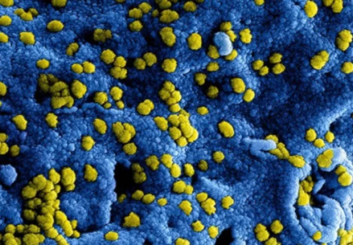 Por año, más de 700.000 personas mueren a causa de infecciones por bacterias resistentes a los antibióticos. Pixabay