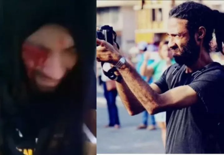 Exigen justicia en el caso de agresión del fotógrafo Aubrey Baxter. Foto: Cortesía