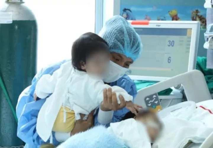Fotografía cedida por el Ministerio de Salud de Perú que muestra la favorable recuperación de dos gemelos siameses tras su cirugía. Foto: EFE