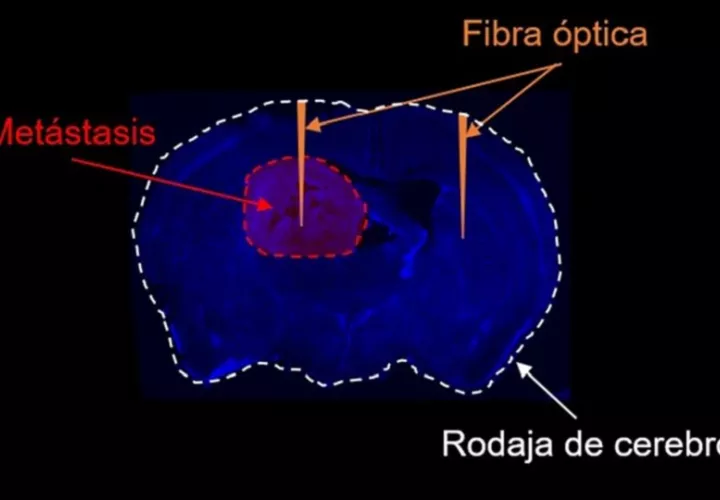 Esquema de funcionamiento de la ‘linterna molecular’. Mariam Al-Masmudi. CNIO