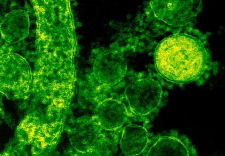 Bacteria Come carne es una infección en la sangre produce lesiones en la piel con ampollas, además de fiebre, escalofríos y presión baja.Foto: ilustrativa